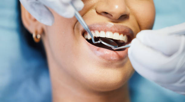 Best Emergency Gum Treatment in Hill City, KS